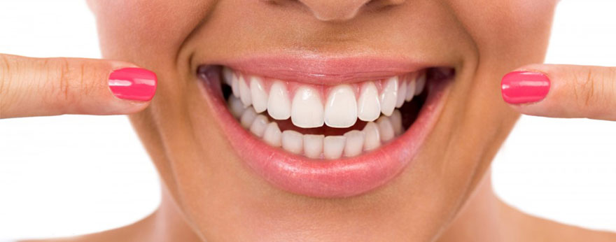LG آنالیز لبخند در دندانپزشکی