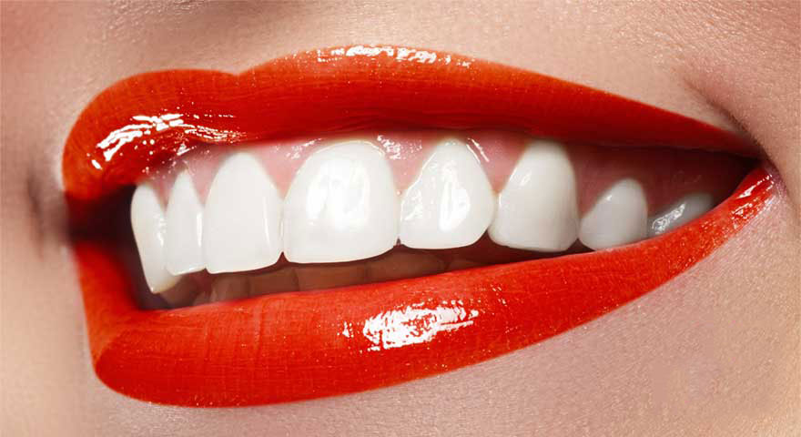 LG دندانپزشک-زیبایی-کیست1